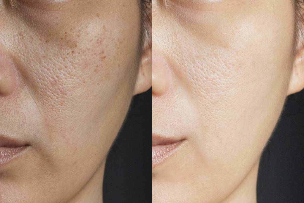 serum enlarged pores beautiful skin
