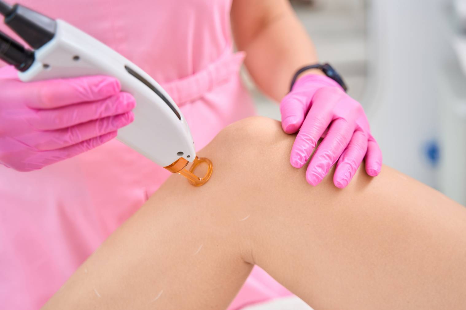 permanent laser hair removal